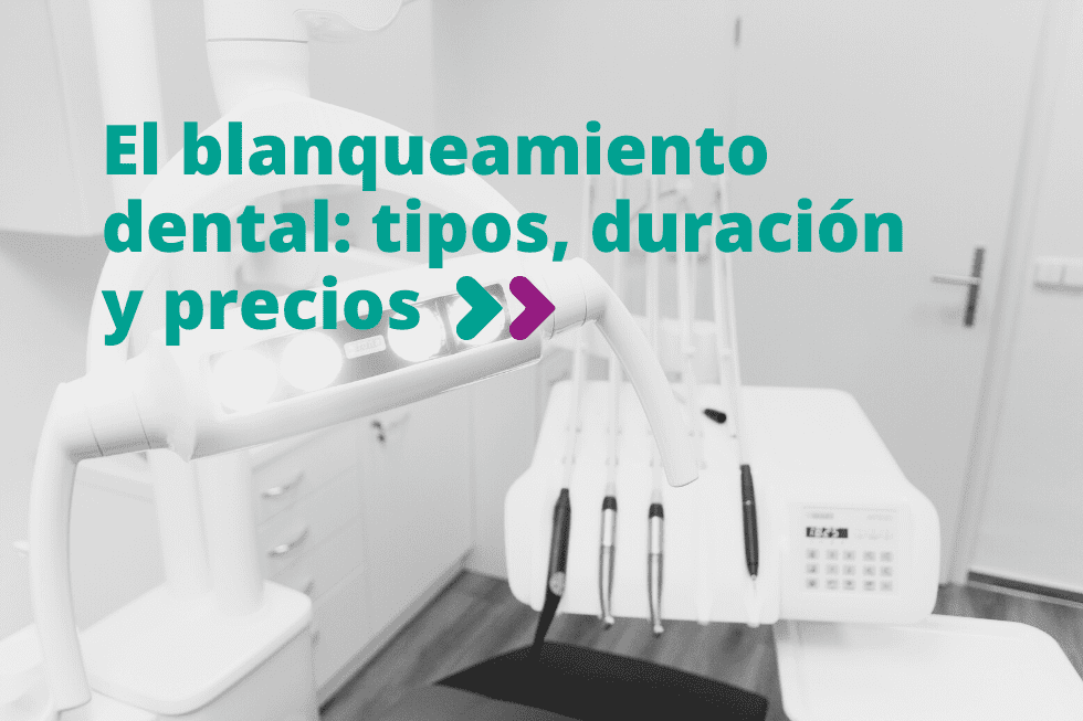 Blanqueamiento dental: precio, tipos y duración