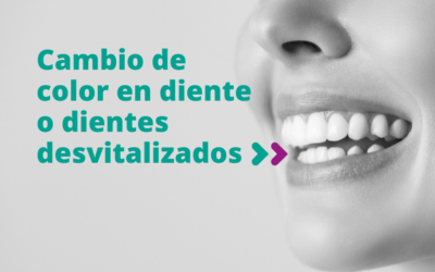 Cambio de color en diente o dientes desvitalizados