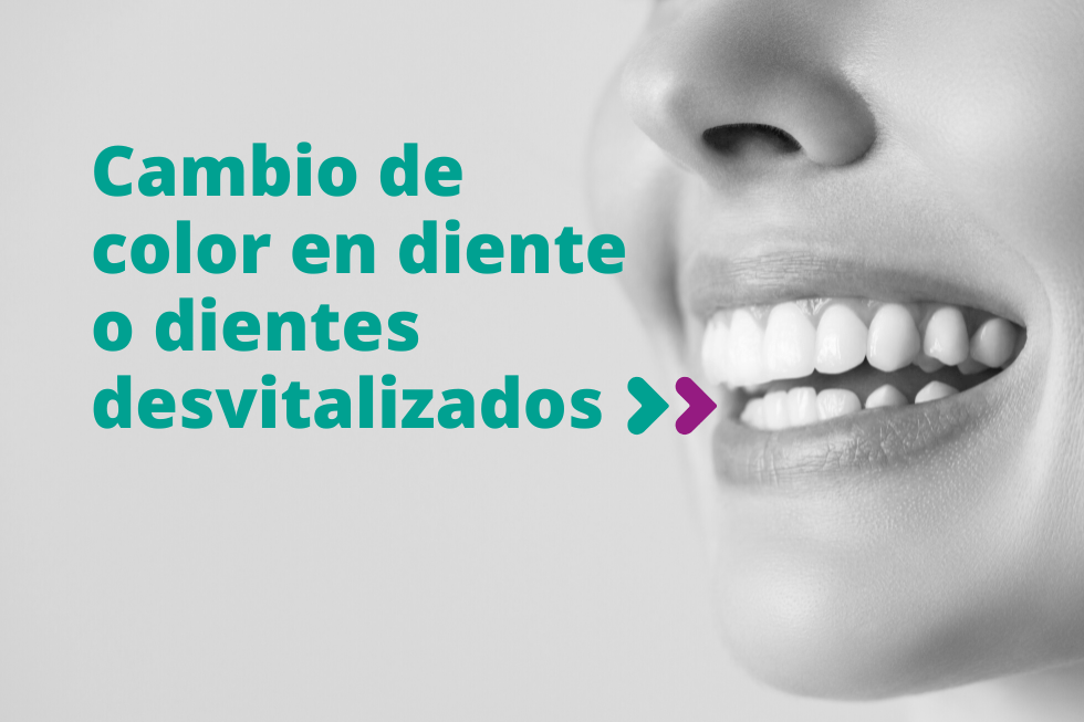 Cambio de color en diente o dientes desvitalizados