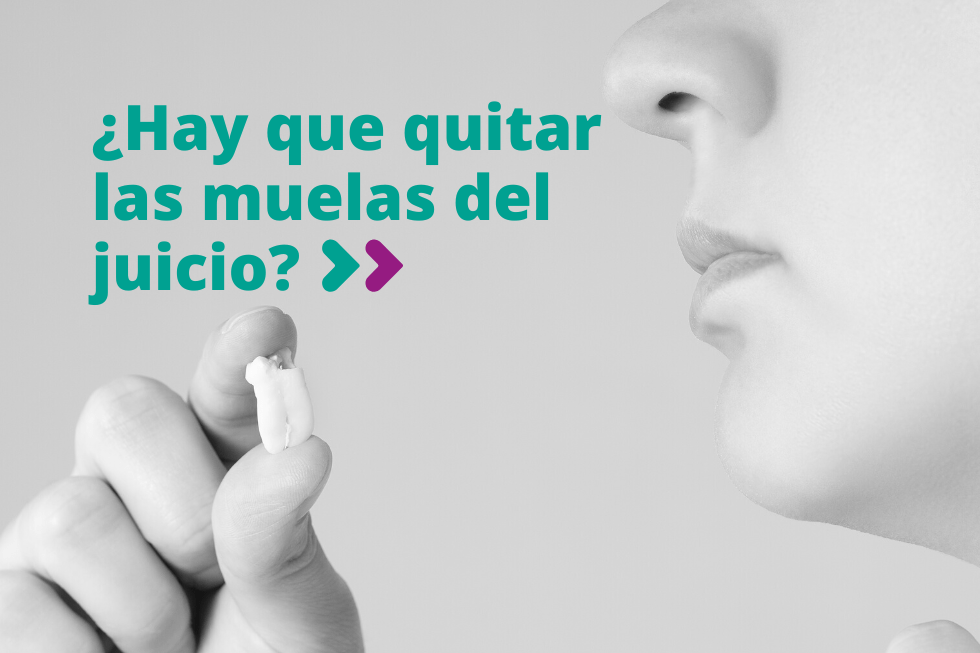 ¿Hay que quitar las muelas del juicio?