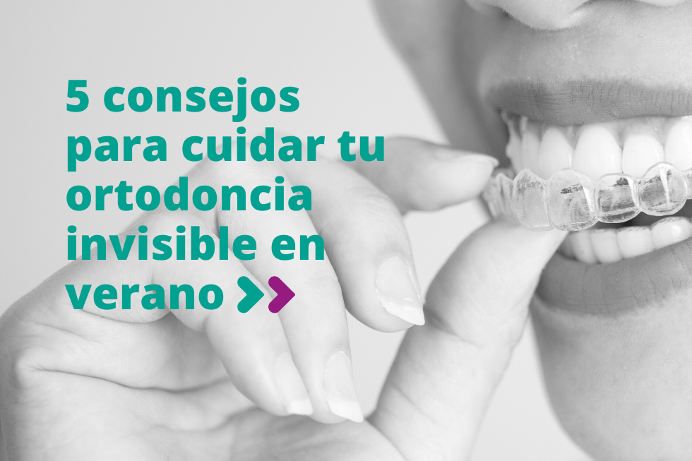 5 consejos para cuidar tu ortodoncia invisible en verano