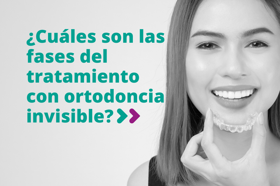 fases del tratamiento con ortodoncia invisible