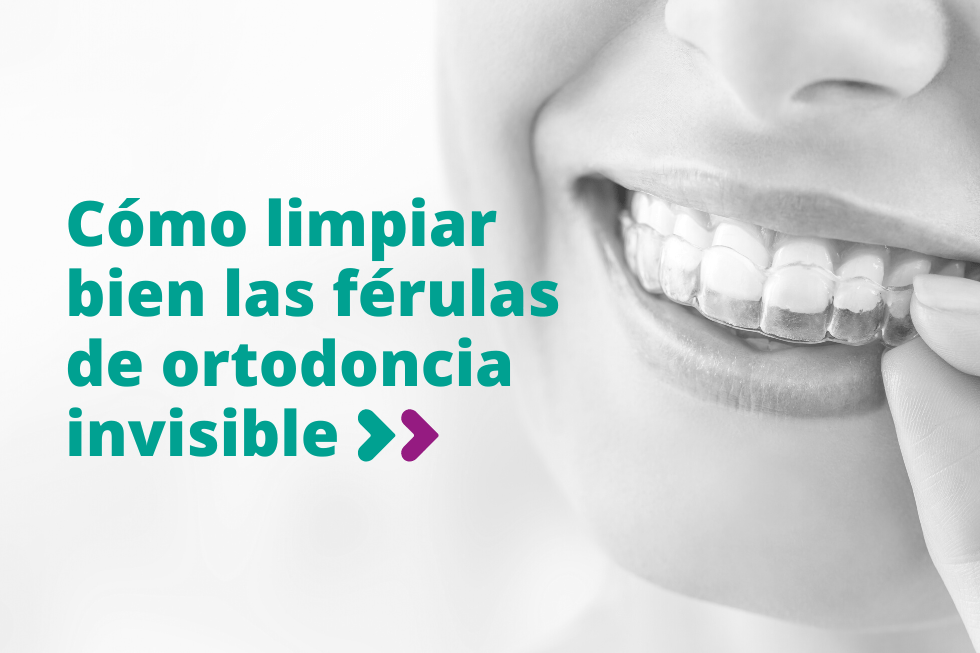 Cómo limpiar bien las férulas de ortodoncia invisible