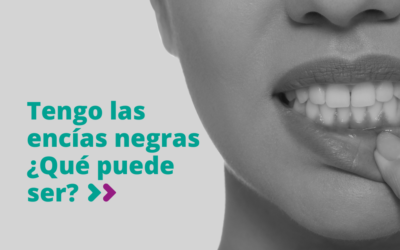 Tengo las encías negras ¿qué puede ser?