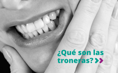 ¿Por qué salen las troneras?