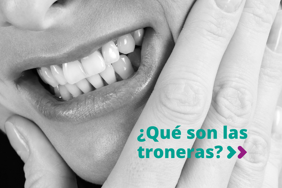 ¿Por qué salen las troneras?