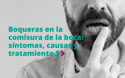Boqueras en la comisura de la boca: síntomas, causas y tratamiento