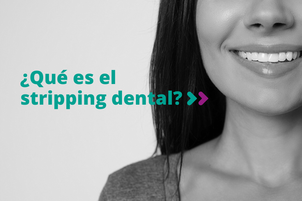 Qué es el stripping dental y para qué sirve