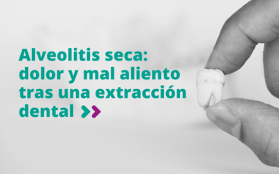 Alveolitis seca: dolor y mal aliento tras una extracción dental