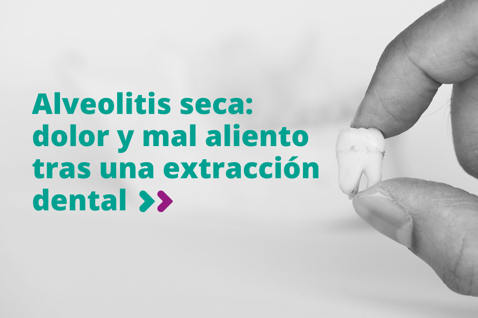 Alveolitis seca: dolor y mal aliento tras una extracción dental