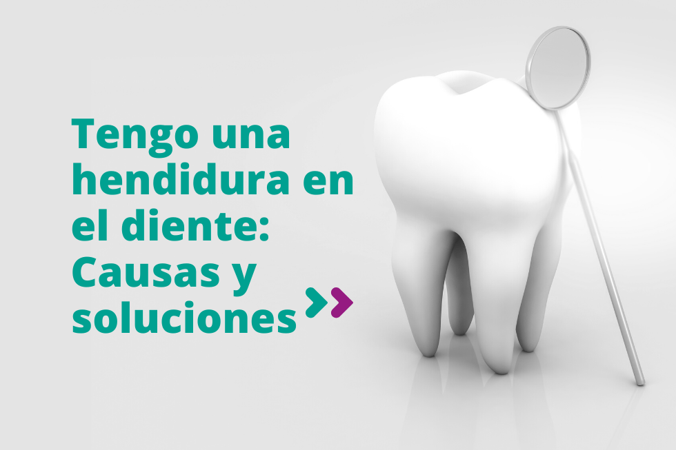 Tengo una hendidura en el diente: causas y soluciones