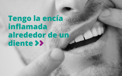 Tengo la encía inflamada alrededor de un diente
