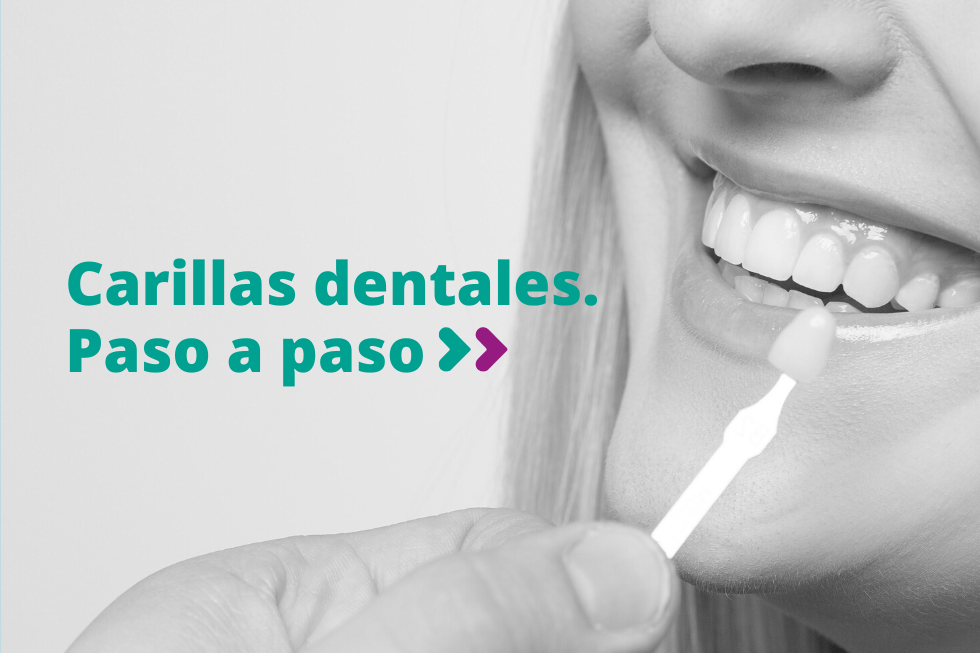 Carillas dentales en Pedrera, paso a paso