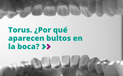 Torus. ¿Por qué aparecen bultos en la boca?