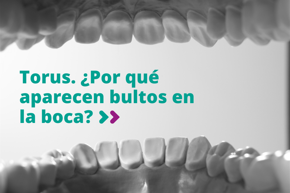 Torus. ¿Por qué aparecen bultos en la boca?