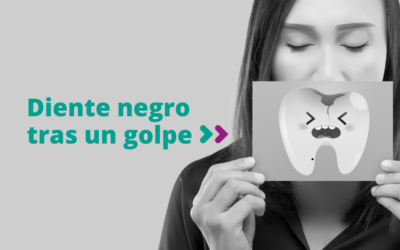 Diente negro tras un golpe, ¿qué puedes hacer?