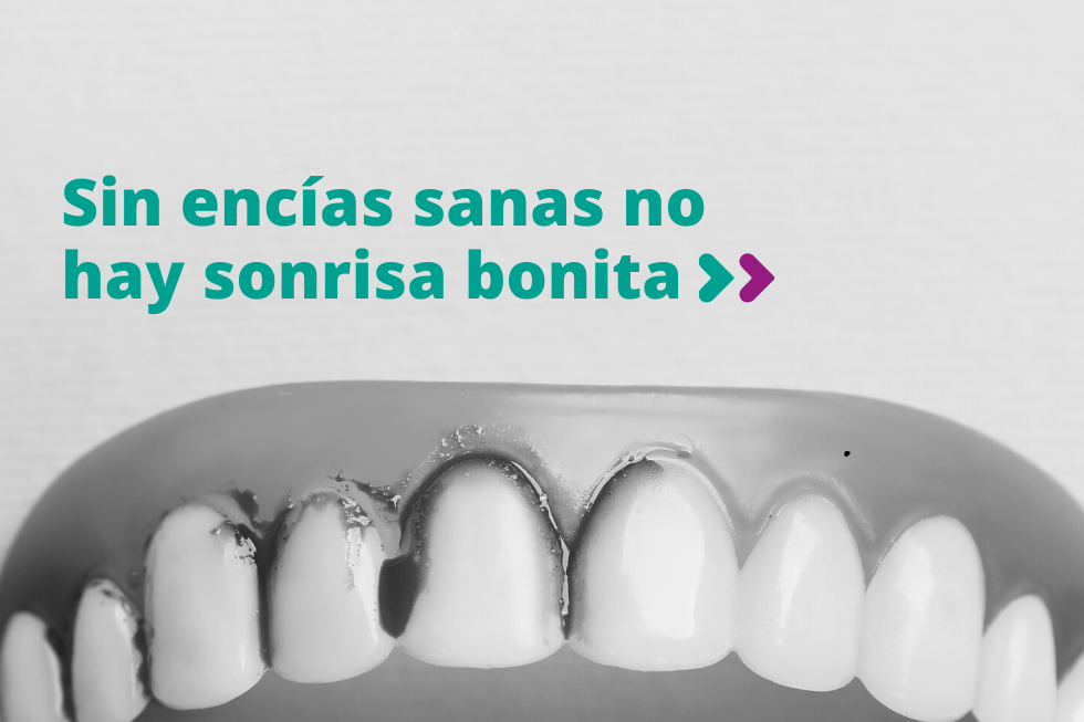 Sin encías sanas no hay sonrisa bonita