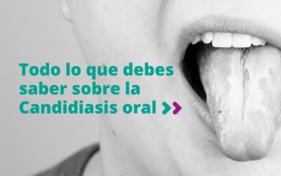 Todo lo que debes saber sobre la Candidiasis oral