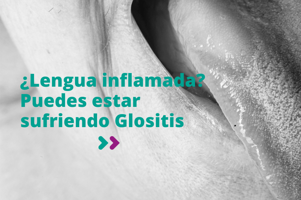 Glositis o lengua inflamada