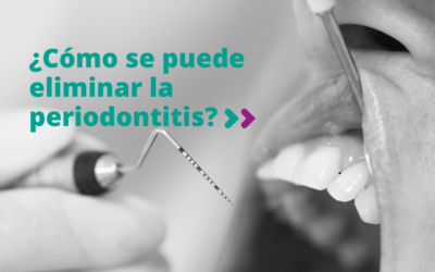 Cómo se puede eliminar la periodontitis