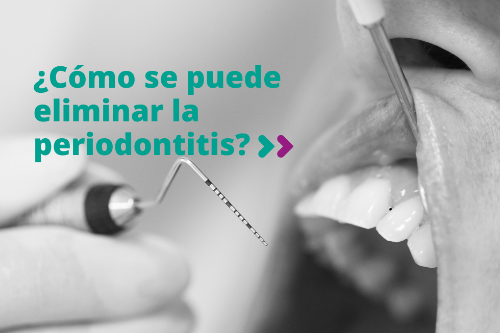 Cómo eliminar la periodontitis