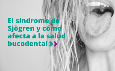 El síndrome de Sjögren y cómo afecta a la salud bucodental