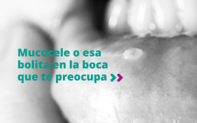 Mucocele o esa bolita en la boca que te preocupa