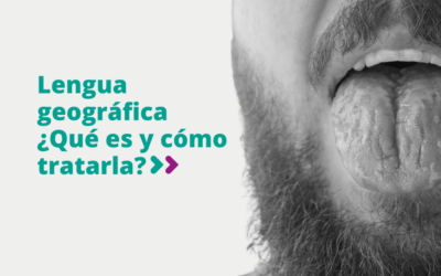 Lengua geográfica ¿qué es y cómo tratarla?