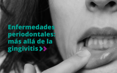 Enfermedades periodontales: Más allá de la gingivitis