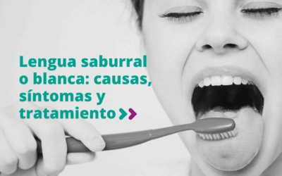Lengua saburral o blanca: causas, síntomas y tratamiento