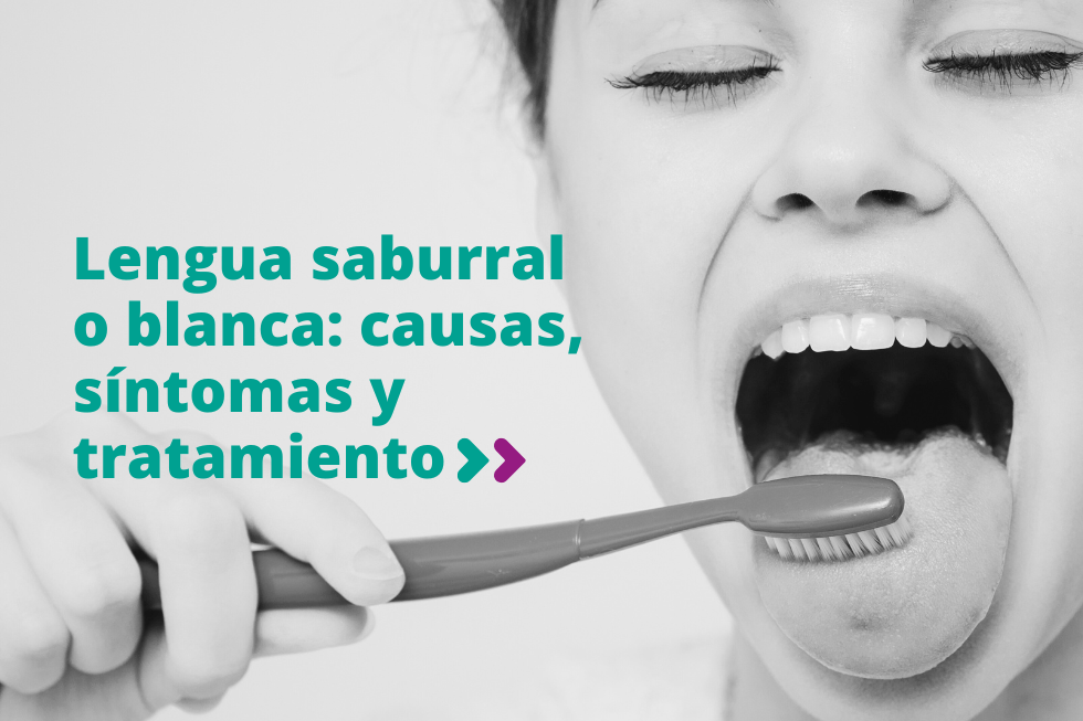 Lengua saburral o blanca: causas, síntomas y tratamiento