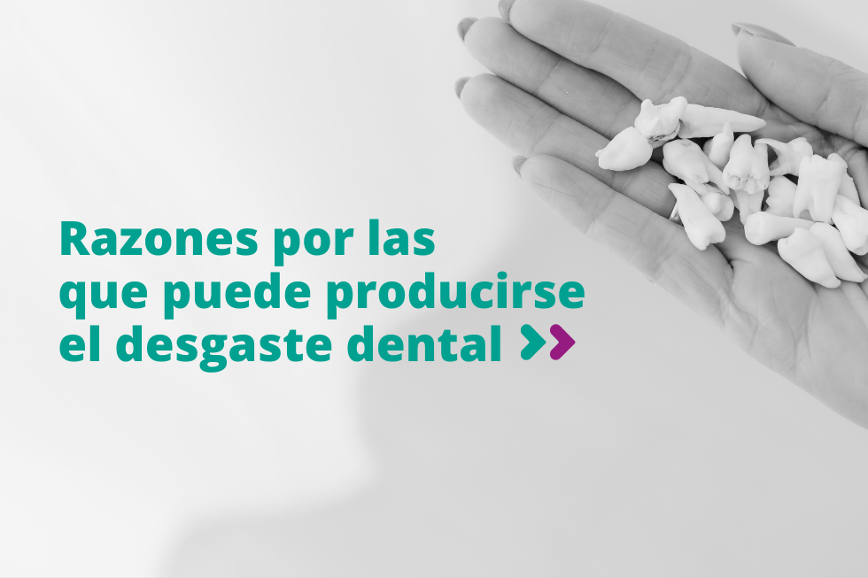 Razones por las que puede producirse el desgaste dental