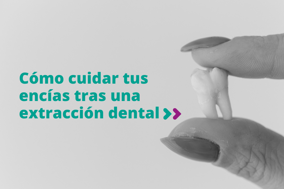 Cómo cuidar tus encías tras una extracción dental