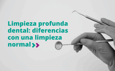 Limpieza dental profunda: qué diferencia hay con una limpieza normal