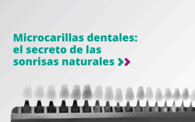Microcarillas dentales: el secreto de las sonrisas naturales