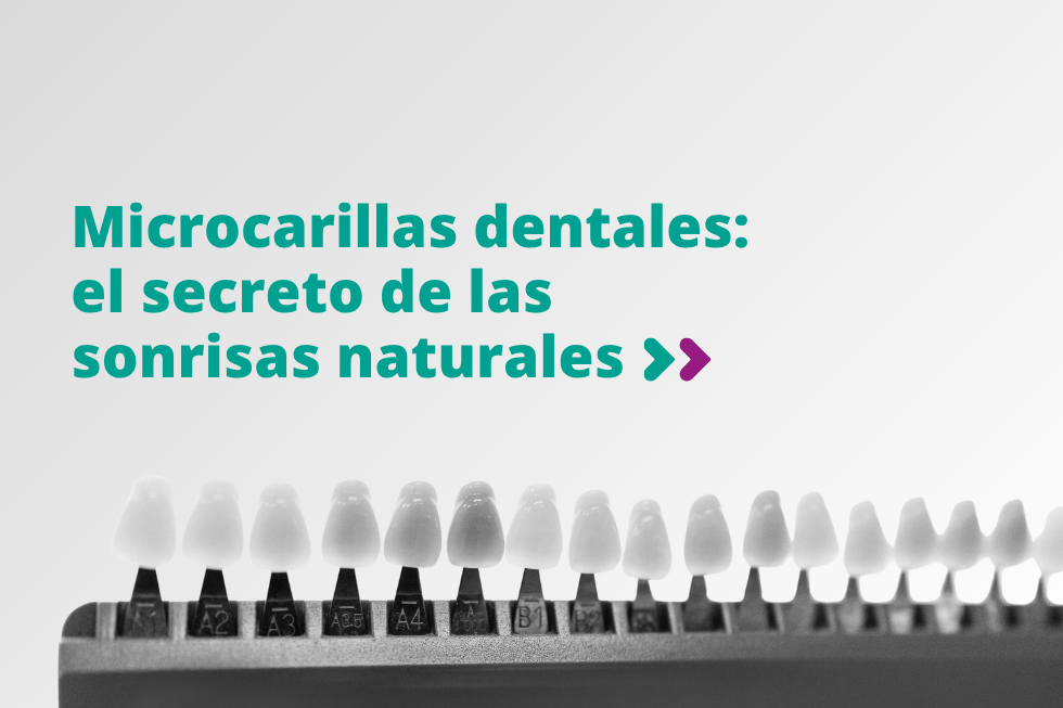microcarillas dentales