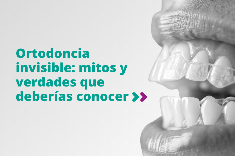 Mitos ortodoncia invisible
