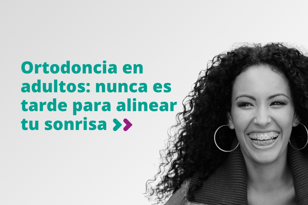 Ortodoncia en adultos: nunca es tarde para alinear tu sonrisa