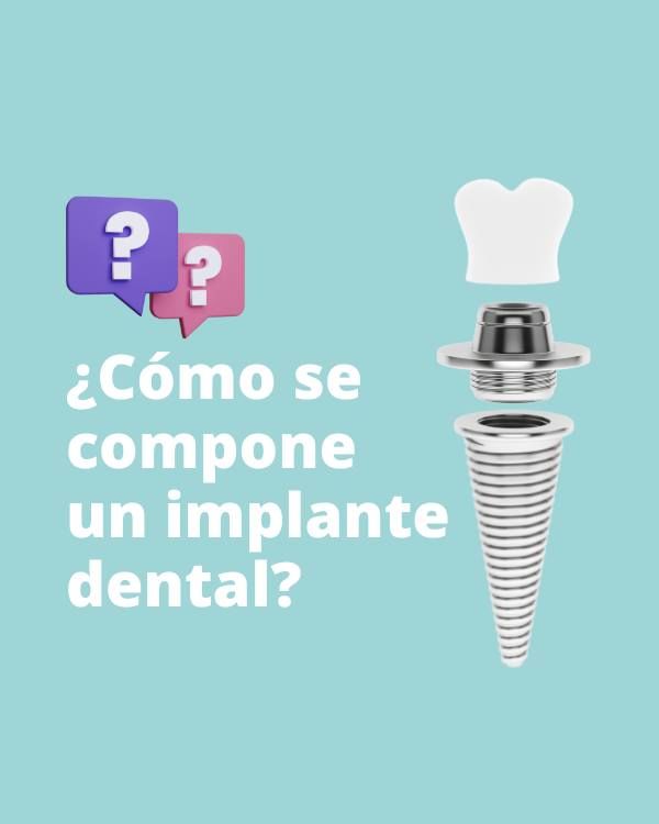 ¿Cómo se compone un implante dental?🔩🦷

🦷 Corona: Es la pieza dental artificial colocada sobre el pilar consiguiendo el tono similar al resto de piezas dentales.

🟣 Pilar: Pieza intermedia entre tornillo y corona que ayuda a la adaptación completa de la prótesis.

🔩 Tornillo: Sustituimos la raíz del diente por un tornillo que se adapta al hueso. 100% biocompatible al ser de titanio.

En Isdent contamos con un riguroso procedimiento en implantología en Pedrera. Solicita información: 

📍C. Nardo, 15. Pedrera, Sevilla
📞 660 834 040

#pedrera #pedrerasevilla #sevilla #gilena #martindelajara #estepa #osuna #larodadeandalucia #dentista #implantes #ortodoncia #endodoncia #periodoncia #odontopediatría #esteticadental #salud #clinicadental #odontolove